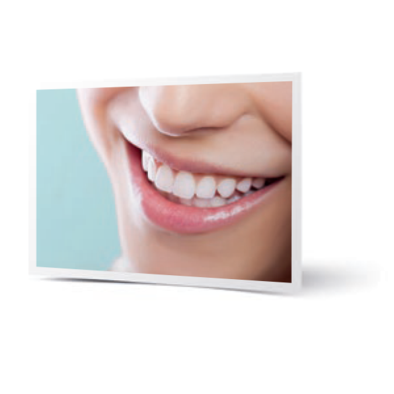 5 - SMILE